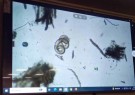 Personal de zoonosis se capacitó en el diagnóstico de trichinellosis 